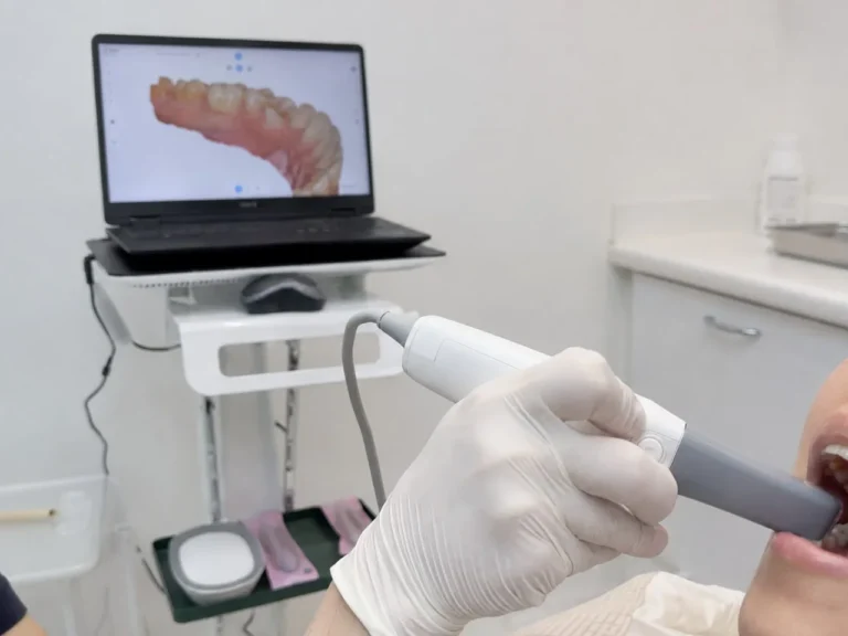Scanner in der Praxis beim digitalen Abdruck