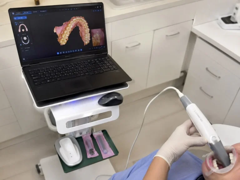 Digitale Zahnscan-Software auf dem Bildschirm