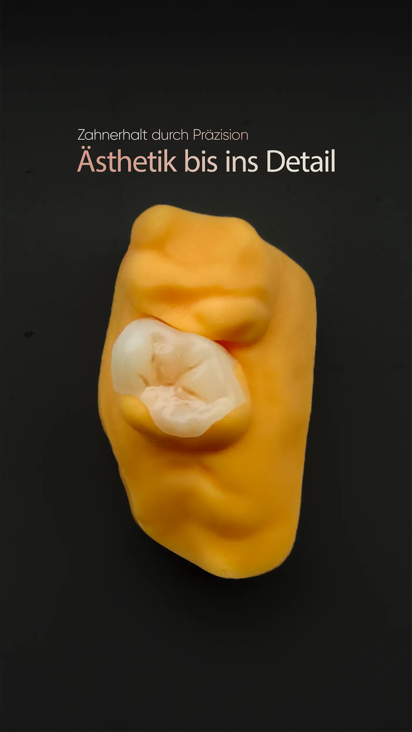 3D-Druck Bohrschablone & Implantat-Planung