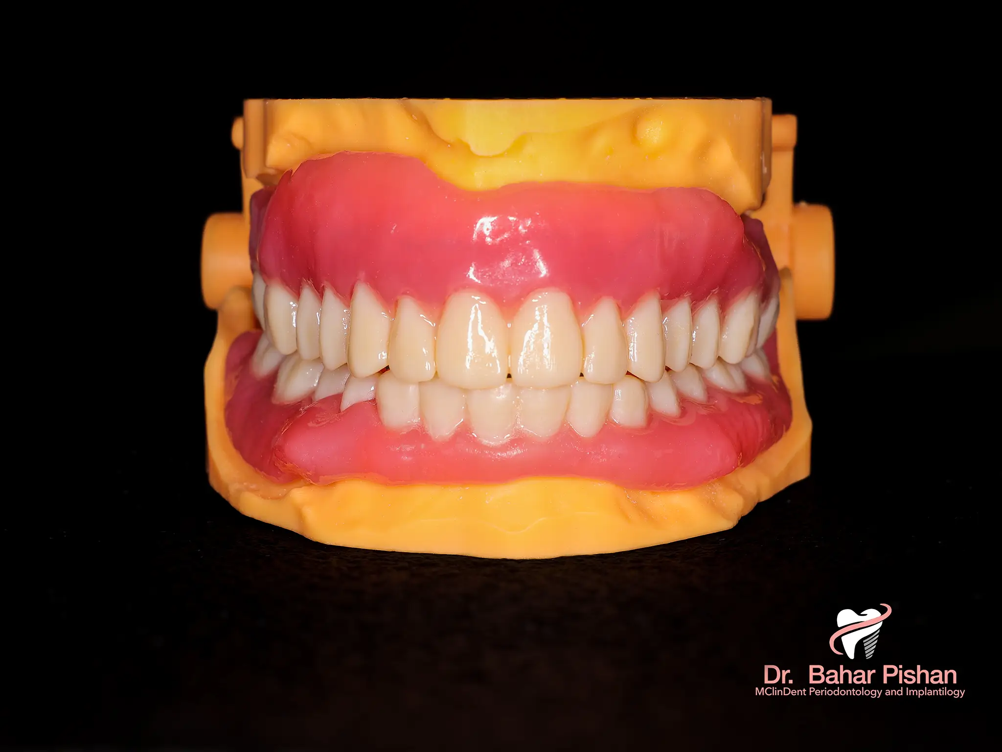 Prothesensystem aus dem 3D-Drucker